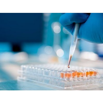 Добавление ингибитора PD-1 к химиолучевой терапии усиливает полный ответ при резектабельном раке пищевода