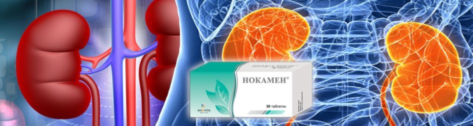 СРАВНИТЕЛЬНОЕ ИССЛЕДОВАНИЕ ЭФФЕКТИВНОСТИ НОКАМЕНА ПО ПРЕДОТВРАЩЕНИЮ ОБОСТРЕНИЙ ХРОНИЧЕСКОГО РЕЦИДИВНОГО ЦИСТИТА У ЖЕНЩИН
